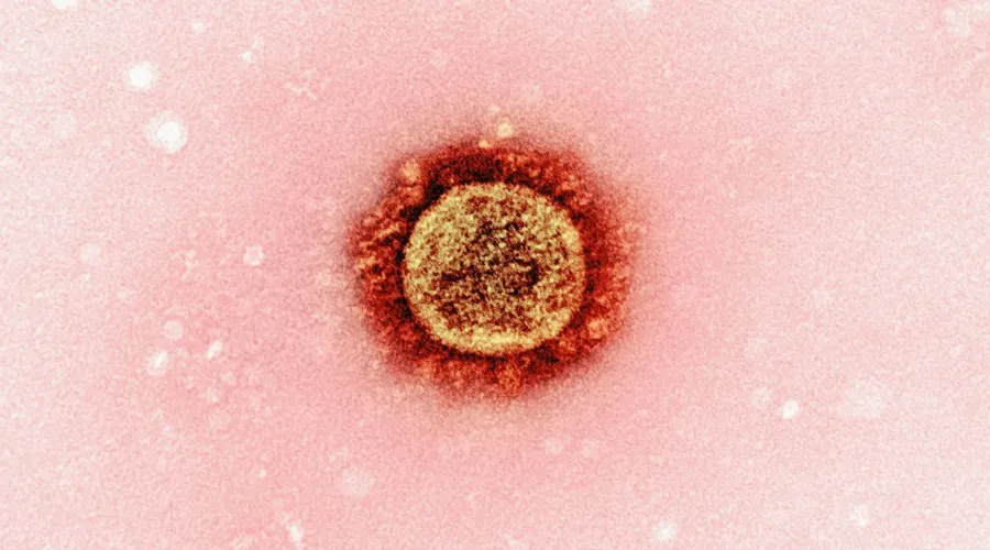 herpes