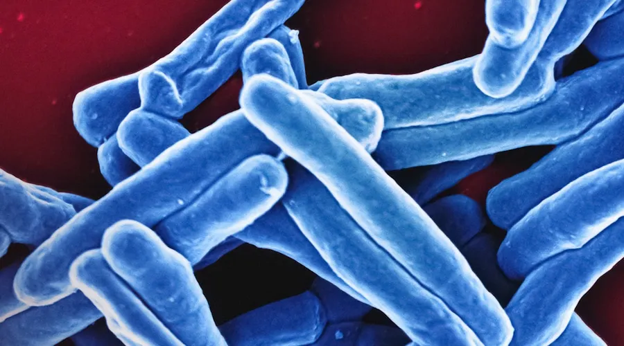 antibiotikaresistenz