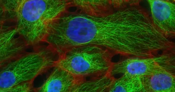 New Cell Therapies Against Melanoma Advance Toward Wider Clinical Use